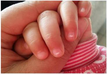 宝宝的指甲里藏着健康大玄机?还是又被挖坑儿了?